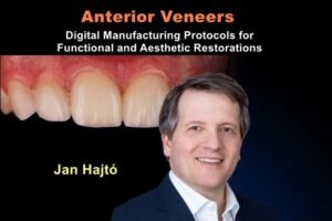 Anterior Veneers: Digital Manufacturing Protocols for Functional and Aesthetic Restorations