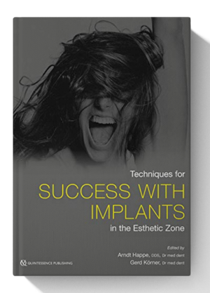 Techniques for Success With Implants in the Esthetic Zone 1st Edition
