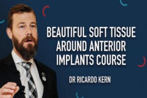 Beautiful Soft Tissue Around Anterior Implants