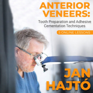 Anterior Veneer: Tooth Preparation and Adhesive Cementation Techniques