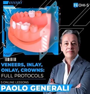 Veneers, Inlay, Onlay, Crowns: Full Protocols