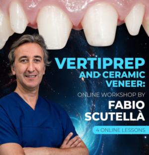 Vertical Preparation and Ceramic Veneers
