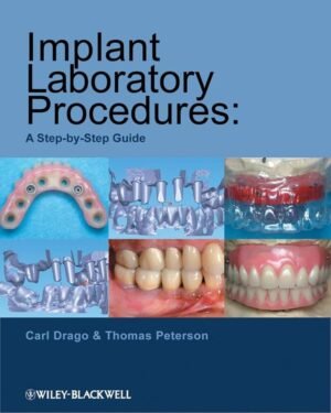Implant Laboratory Procedures: A Step-by-Step Guide