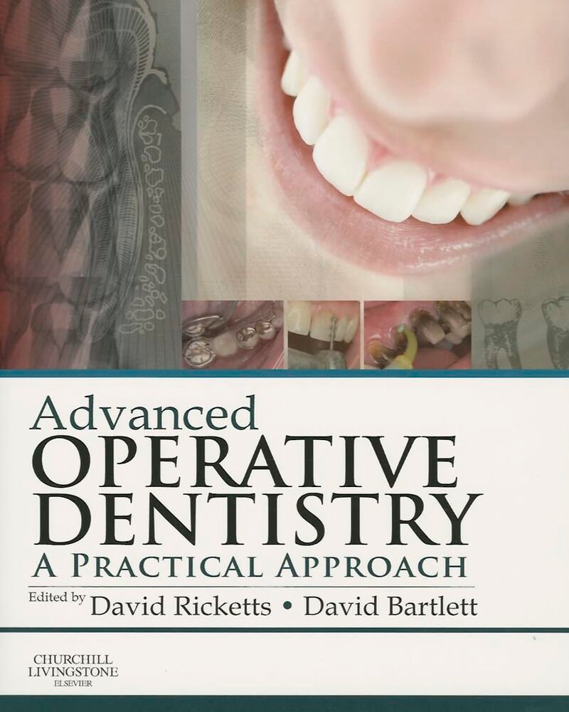 Advanced Operative Dentistry: A Practical Approach