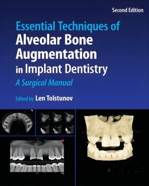 Essential Techniques of Alveolar Bone Augmentation in Implant Dentistry: A Surgical Manual
